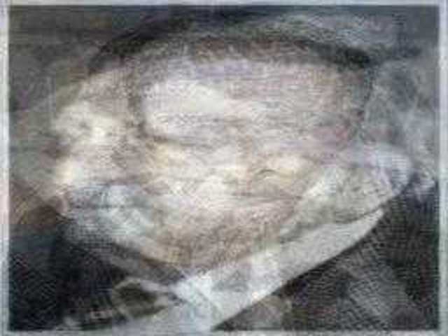 autoscopia: Albert_Drach