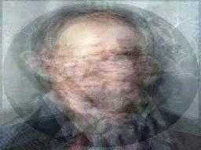 autoscopia: William_Forsyth